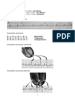 3 EKG Tulburari de ritm si de conducere