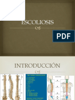 ESCOLIOSIS