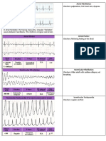 Sarishka Singh - ECG For PLAB 1