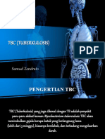 Tuberculosis Presentation