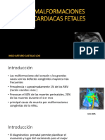 Malformaciones Cardiacas Castillo PDF
