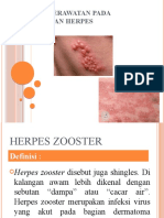 Askep Herpes Zoster