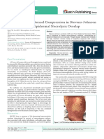 Case Report of External Compression in Stevens-Johnson Syndrome-Toxic Epidermal Necrolysis Overlap