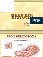 Shoulder Shoulder Shoulder Dystocia Dystocia Dystocia