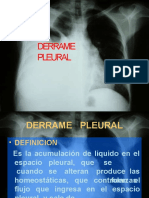 Derrame Pleural 4