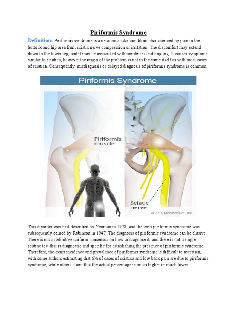 Piriformis Syndrome: Sciatic Nerve Pain | PDF | Diseases And Disorders ...