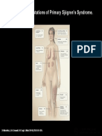 Systemic Effects of Sjögren's Syndrome