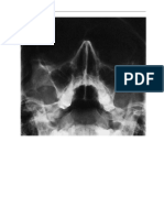 Pocket Atlas of Radiographic Anatomy 21-30