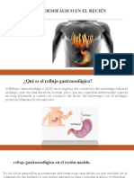 RGE en recién nacidos: síntomas y tratamiento