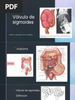 Vólvulo Sigmoideo: Diagnóstico y Manejo | PDF | Intestino grueso ...
