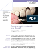 2 Tratamiento estético implantario en el diente 21