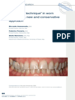 The "Index Technique" in Worn Dentition - A New and Conservative Approach
