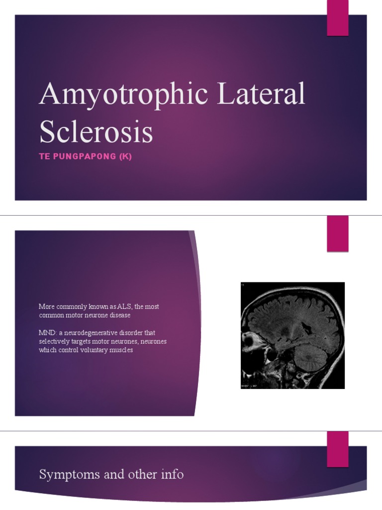 Understanding Amyotrophic Lateral Sclerosis | PDF