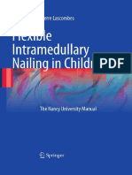 Flexible Intramedullary Nailing in Children The Nancy University Manual