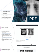 Deep Learning For COVID-19 Detection On Chest X-Ray