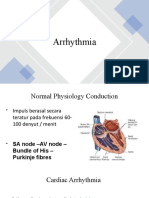 Arrhythmia Overview