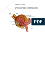 Glomerulonefritis Aguda