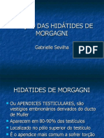 Torção Das Hidátides de Morgagni