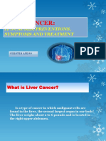 Liver Cancer:: It'S Causes, Preventions, Symptoms and Treatment
