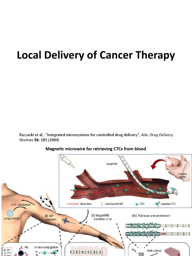 BIOENG472 TOPIC10 Localized CancerTherapy | PDF | Immunotherapy | Neoplasms