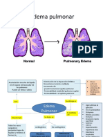 Edema Pulmonar y Embolismo Pulmonar