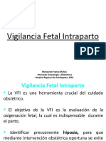 Vigilancia Fetal Intraparto