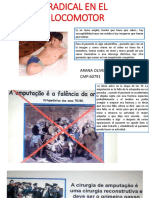 Amputaciones PDF