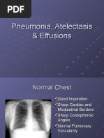 Cicatricial Atelectasis Overview | PDF | Respiratory System | Causes Of ...