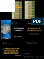 Preparaciones Funcionales - Incrustaciones