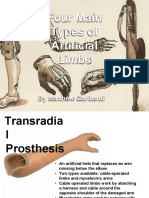 Four Main Types of Artificial Limbs: by Matthew Garibaldi