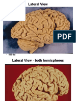 GrossBrain-Views.ppt