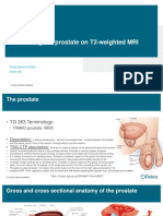 Contouring The Prostate On T2-Weighted MRI