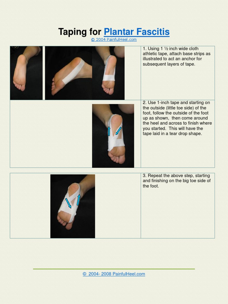 Plantar Fascitis Taping PDF Foot Limbs (Anatomy)