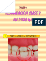 CEI RESTAURACIÓN CLASE V