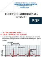 Electrocardiograma Normal