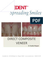 direct_composite_veneer.pdf