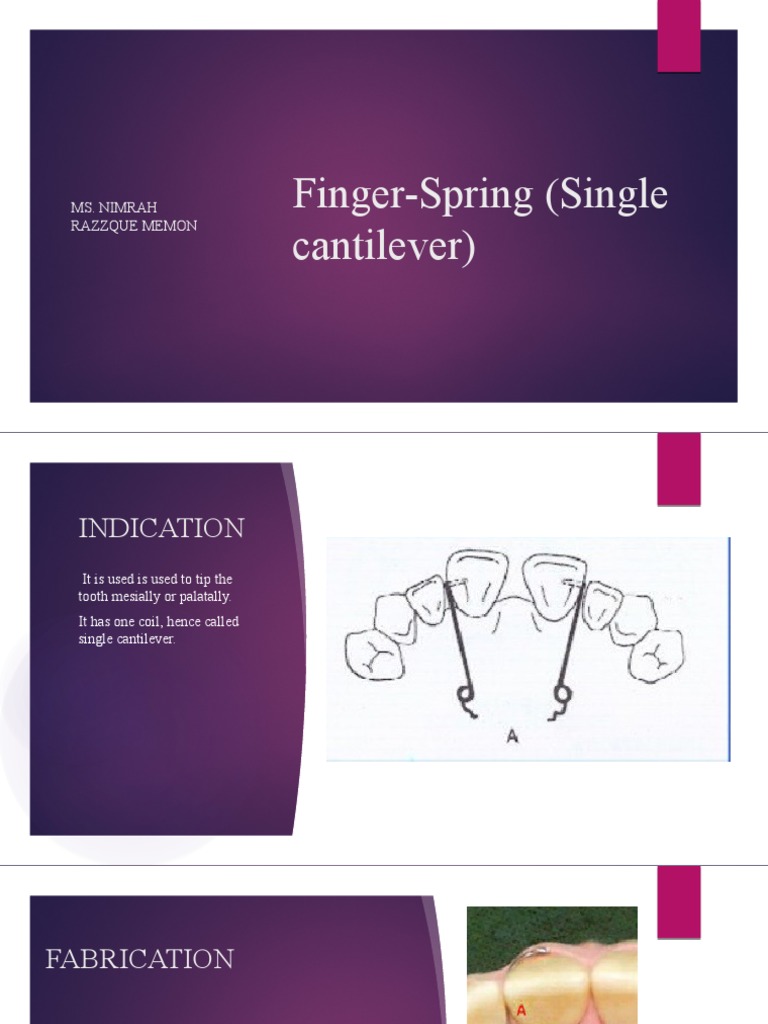 Finger Spring: Single Cantilever Guide | PDF