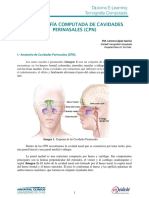 02 Cavidades Perinasales PDF