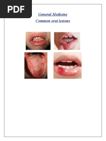 Common Oral Lesions