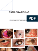 AULA 2- Oncologia ocular