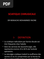 sciatique