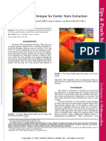 A Novel Technique For Exeter Stem Extraction.8