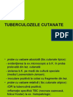 Curs 5-TBC,Parazitoze.ppt