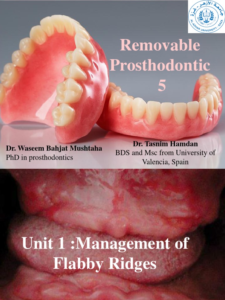 Management of Flabby Ridges in Dentures | PDF | Dentures | Dentistry ...