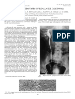 Prostatic Metastases of Renal Cell Carcinoma