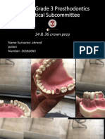 DPC300 Grade 3 Prosthodontics Practical Subcommittee: 34 & 36 Crown Prep