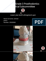 DPC300 Grade 3 Prosthodontics Practical Subcommittee: Lower Jaw Teeth Alinegment Quiz