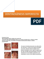 Dentinogénesis Imperfecta