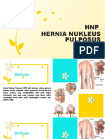 Hernia Nukleus Pulposus-1