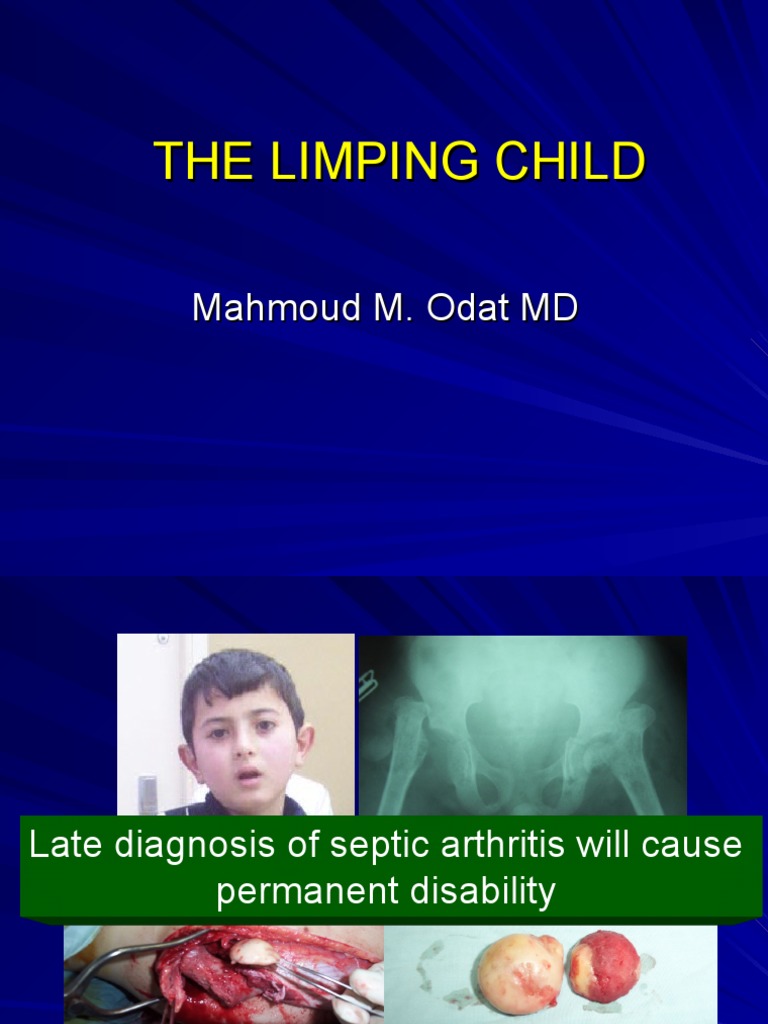 Pediatric Limp Diagnosis Guide | PDF | Radiography | Clinical Medicine